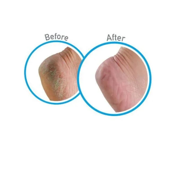 Feet Foot (5-Pack) Healthy 3oz. Cream