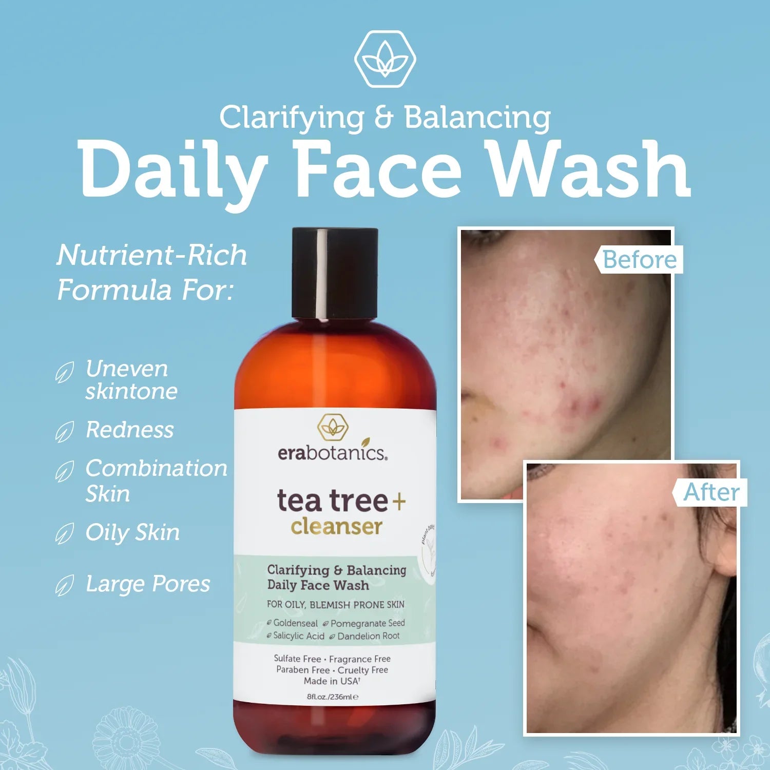 Body Organics Cleanser and Tea Wash Oil Face 8oz Era Tree