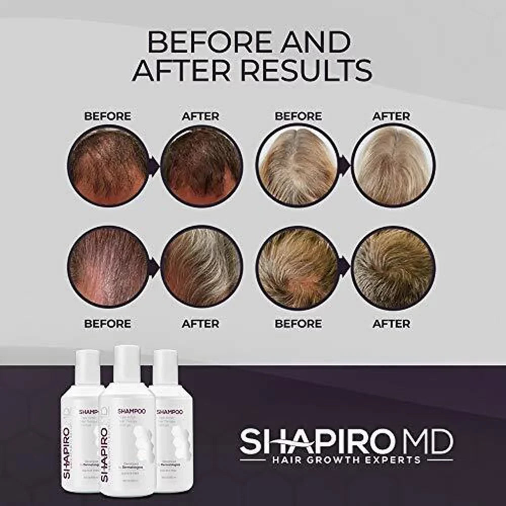Fighting MD DHT Hair, Hair Month) Vegan 8 Loss ounce Shapiro for Shampoo, Formula Thinning (1